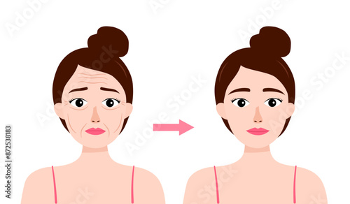 Woman face wrinkles before and after skin care treatment in flat design. Anti-aging therapy.