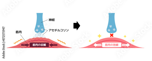 Mechanism of muscle relaxation by Botox. Vectror illustration.