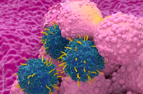 CAR T cell therapy in Breast cancer - closeup view 3d illustration