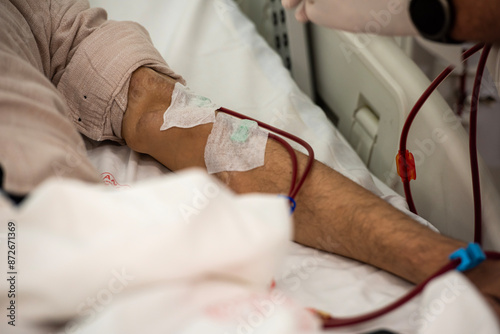 Close-up image of dialysis patients receiving treatment for kidney failure