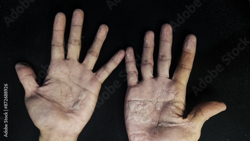 a man's hands and fingers were wrinkles and pale because they had been exposed to rainwater while driving photo