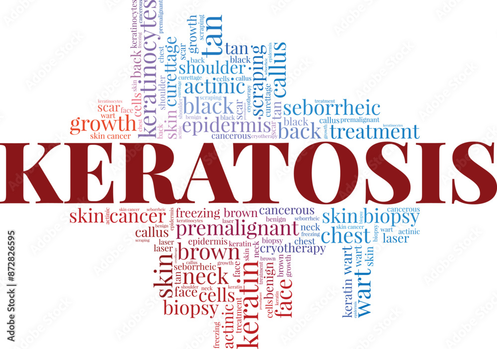 Keratosis word cloud conceptual design isolated on white background. Keratosis word cloud conceptual design isolated on white background.