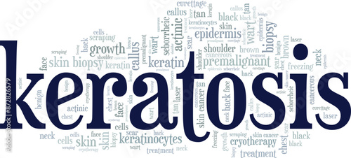 Keratosis word cloud conceptual design isolated on white background.