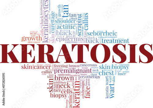 Keratosis word cloud conceptual design isolated on white background.