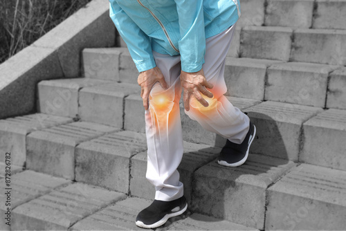 Knee Pain When Going Down Stairs