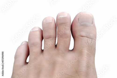 Close-Up of Human Foot with Toenails isolated on White  photo