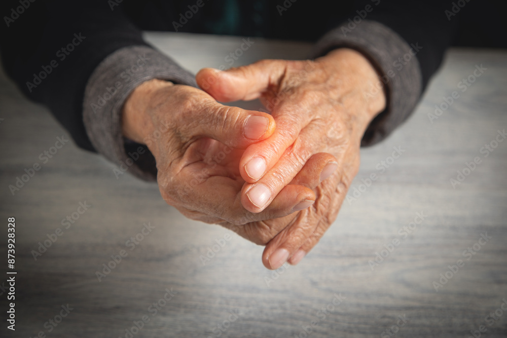 Fototapeta premium Caucasian elderly woman suffering from finger pain.