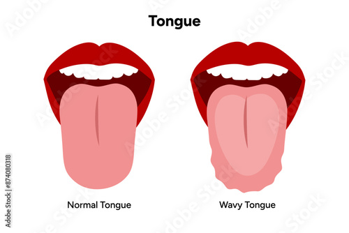 Wavy tongue