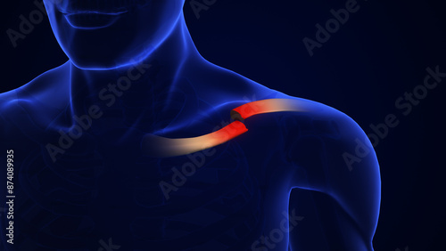 Clavicle Bone Fracture medical concept photo