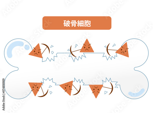 骨粗鬆症の仕組み。破骨細胞と骨芽細胞の役割の違い