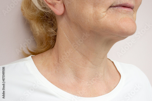 Bild auf Leinwand Close-up of creases and wrinkles on the neck of a elderly woman
