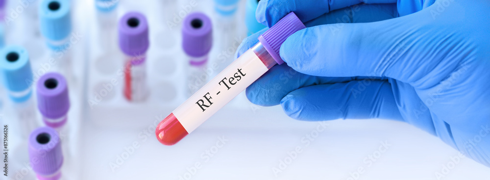 Naklejka premium Doctor holding a test blood sample tube with RF test t on the background of medical test tubes with analyzes. Banner