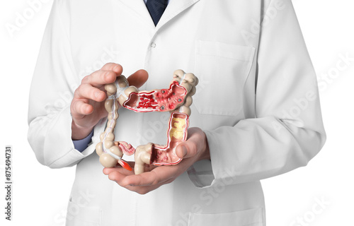 Doctor with model of large intestine on white background, closeup