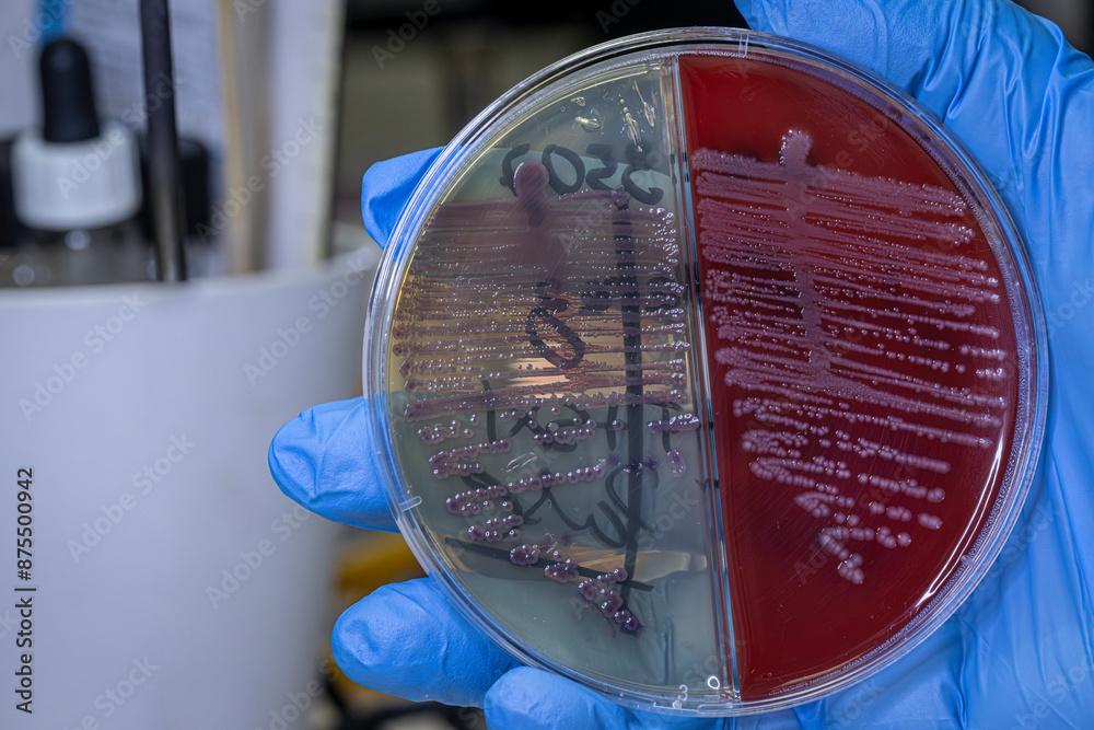 Medical themes: Hand holds a Petri dish with a culture of staphylococcus aureus bacteria Sp.