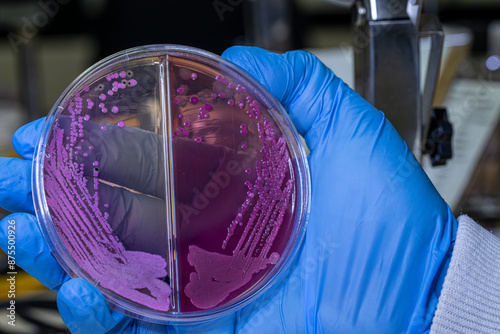 Medical themes: Hand holds a Petri dish with Salmonella bacteria stool culture Sp.