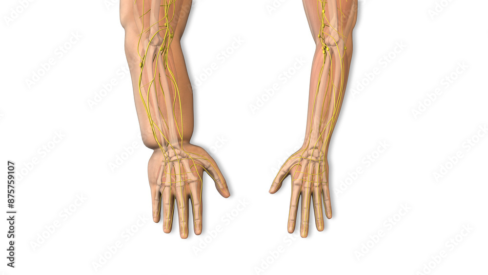 Lymphedema condition causing swelling hands Lymphedema condition causing swelling hands