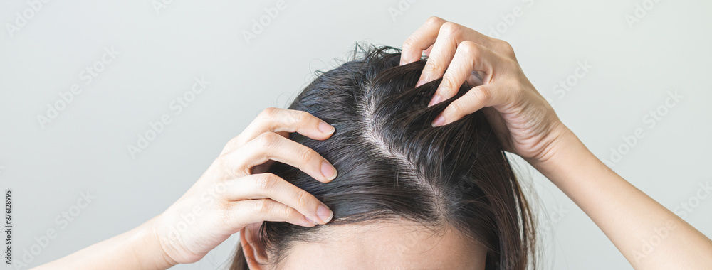 Naklejka premium Damaged Hair symptom, face serious asian young woman, girl worry about balding, looking at scalp in mirror, hand in break into front hair loss, thin problem. Health care treatment for beauty concept.
