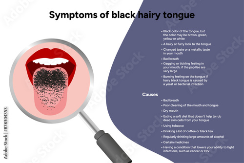 Symptoms of black hairy tongue, medical information 