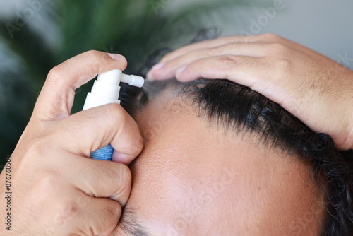 Asian men use serum spray to maintain strong hair and prevent breakage. Man with worry and touching on his head to show a bald head. Hair root nourishment. concept of healthcare, treat, medicine.