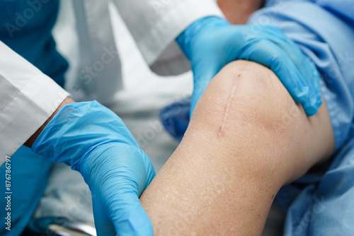 фотографія Asian elderly woman patient with scar knee replacement surgery in hospital