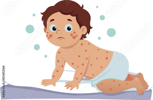 Sad Baby with Chickenpox Rash on Crawling Mat