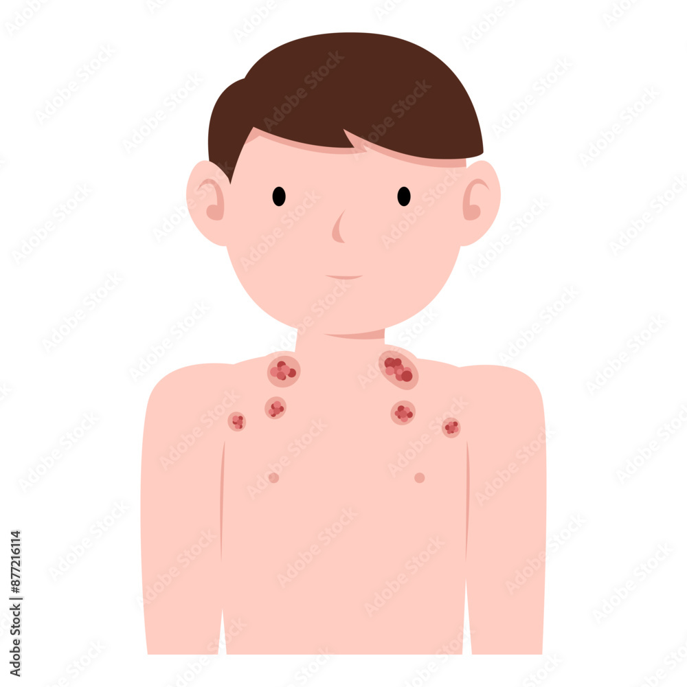 man with cancer lymphoma disease man with cancer lymphoma disease