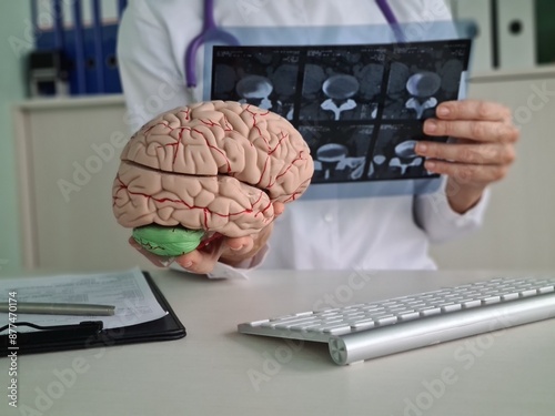 Doctor Holding a Brain Model and Reviewing an MRI Scan in an Office