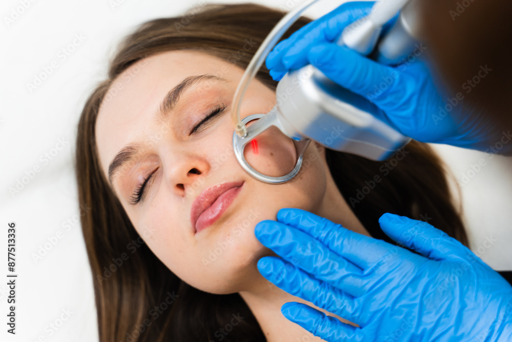 Cosmetologist removes wrinkles and scars using laser from face of attractive girl. Process of facial CO2 laser resurfacing. Cosmetologist removes wrinkles and scars using laser from face of attractive girl. Process of facial CO2 laser resurfacing.
