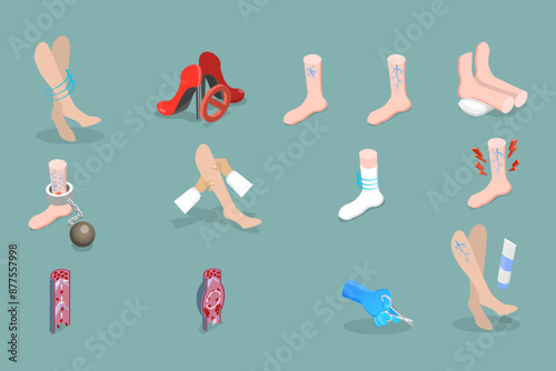 3D Isometric Flat Vector Set of Varicose Treatment, Health Care