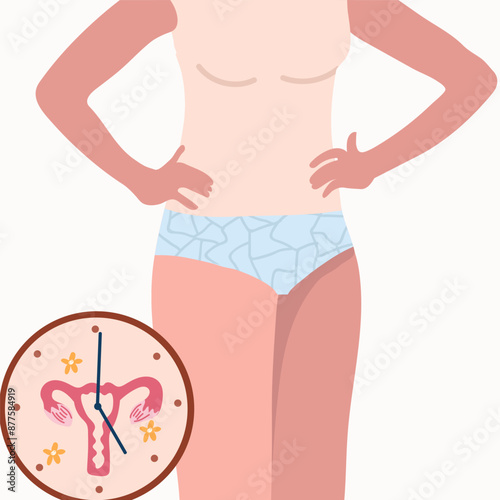 Vector Illustration of menopause. Women's disease. Vaginal dryness. Reproductive system. Female cycle disorder, amenorrhea.