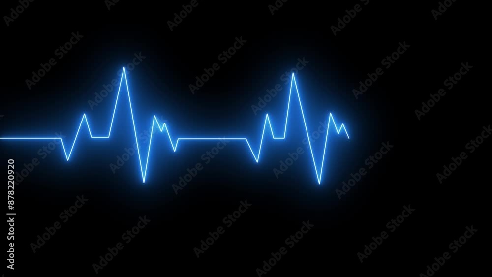 Heart Activity Line,Ecg Ekg Electrocardiogram Monitor