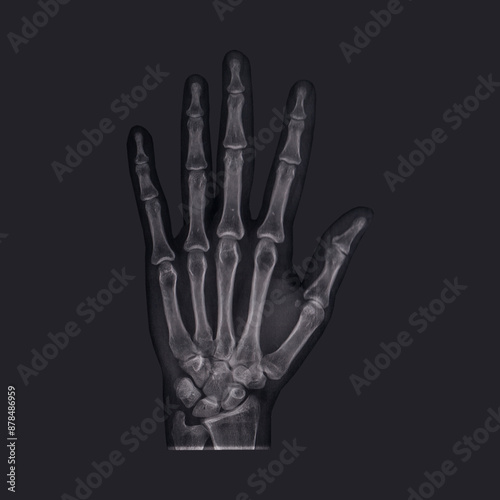 Female hand skeleton, x-ray. Isolate.