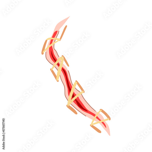 skin suture cartoon. surgical needle, stitch doctor, cut medical skin suture sign. isolated symbol vector illustration
