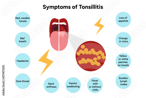 Symptoms of tonsillitis 