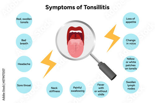 Symptoms of tonsillitis 