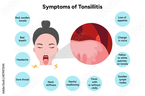 Symptoms of tonsillitis 