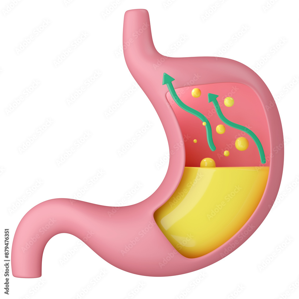 Stomach acid reflux 3D cartoon illustration. Stomach acid reflux 3D cartoon illustration.