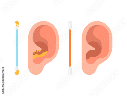 Human ear and ear stick. Ear cleaning stick