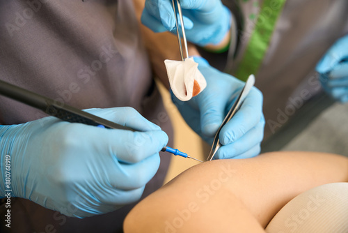 Fotografie Dermatologic surgeon and a medical assistant performing dermal lesion removal