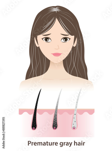 The woman with premature gray hair vector illustration isolated on white background. The mechanism of hair graying with scalp layer. Hair anatomy, hair structure and hair care concept.