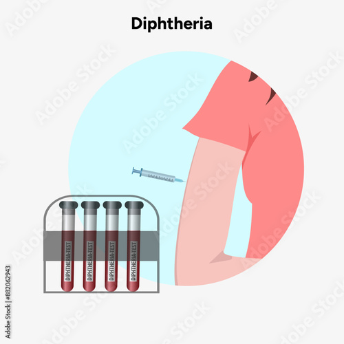 Diphtheria vaccination and  blood tube test   
