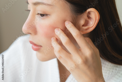 Wallpaper Mural Asian young woman looking face skin in the mirror have a red rash on her face from cosmetic allergy Torontodigital.ca