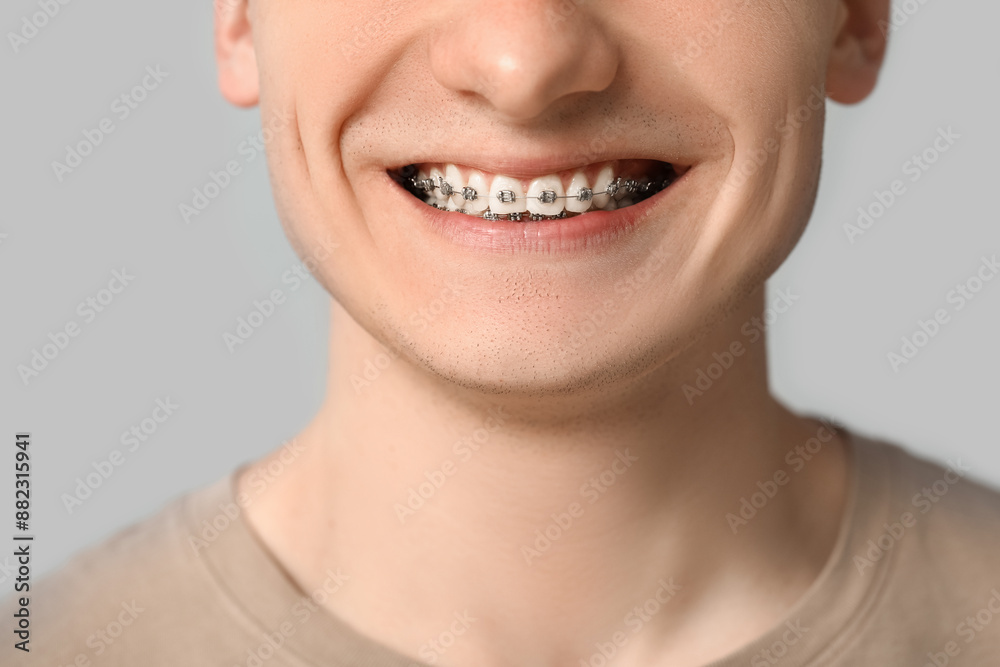 Obraz premium Smiling young man with dental braces on light background, closeup
