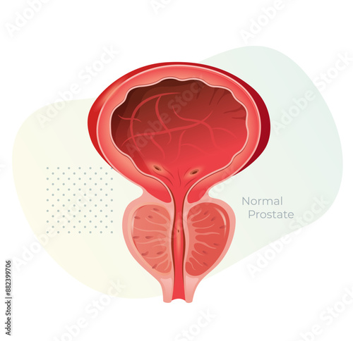 Normal Prostate Gland under Bladder - Stock Illustration