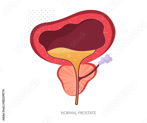 Normal Prostate Gland under Bladder - Stock Illustration