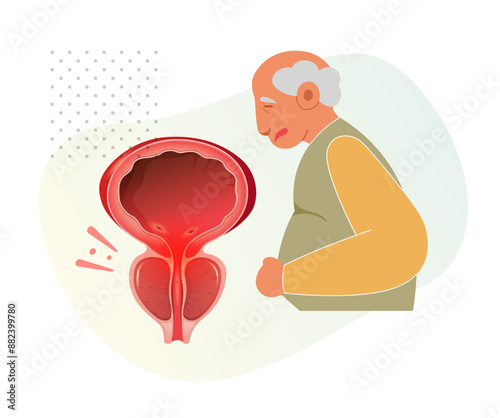 Aged Person with Inflamed Prostate Gland under Bladder - Stock Illustration