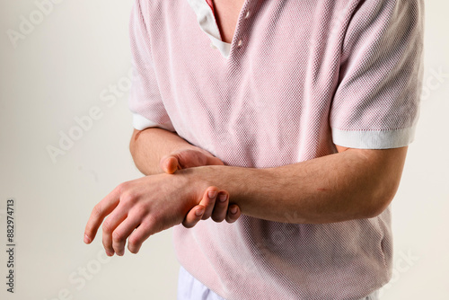 Rheumatoid arthritis causes pain and swelling of wrist. Numbness of arm caused by carpal syndrome. Patient is suffering from hurtful dislocation of wrist bone.