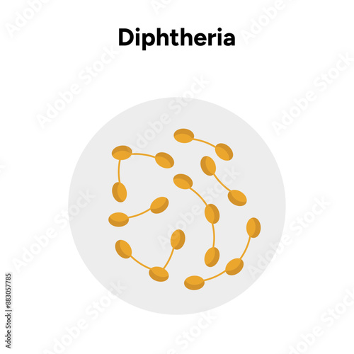Diphtheria illustration zoom medical picture 