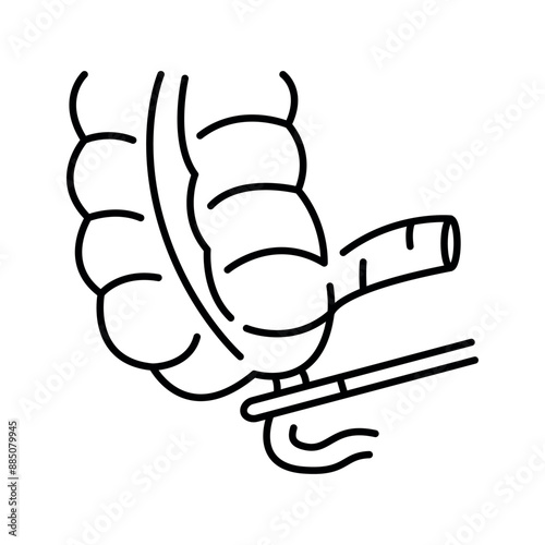 Appendectomy line black icon.