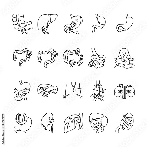 Operations on the abdominal cavity line black icons set.